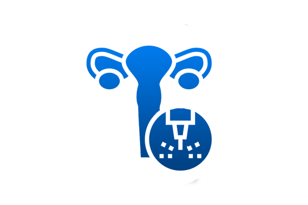 Laparoscopic For Female Urinary Problem Urinary
